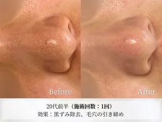 Astorie 相模大野エステのその他イメージ