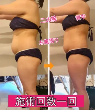 ロング カラー パーマ ヘアアレンジ メンズ キッズ ネイル マツエク・マツパ ‍痩身＆ボディ 結果出し🌟丹野のエステ・リラクイメージ