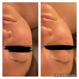 Chii Salon ネイル/痩身エステのネイルデザイン