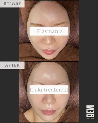 Bevi salonのその他イメージ