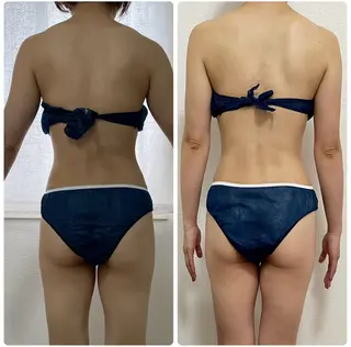 Esthe salon Blanche(エステサロンブランシュ)所属・小顔リフトアップ 美肌改善専門店のエステ・リラクイメージ