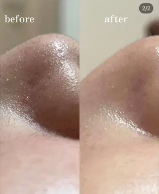 夜限定SARON 💎YISM💎のエステ・リラクイメージ