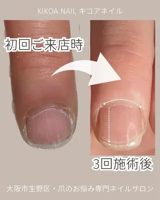 ネイル KIKOA NAIL キコアネイルのネイルデザイン