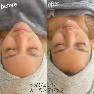 うなじ脱毛/美肌脱毛 LABELのエステ・リラクイメージ