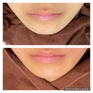 ロング カラー パーマ ヘアアレンジ メンズ キッズ ネイル マツエク・マツパ アイブロウ ニキビ特化型エステ 🍓最短で肌質改善のエステ・リラクイメージ