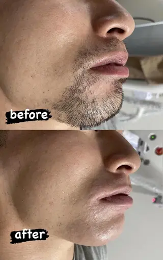 メンズ Epina 千葉店 【エピナ】のエステ・リラクイメージ