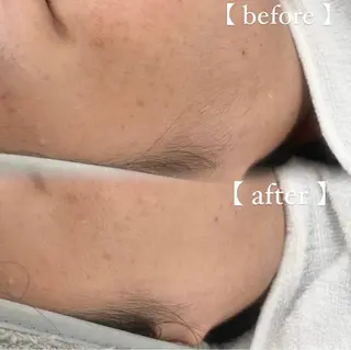 URARA 【lazo】のマツエク・マツパデザイン