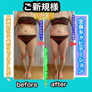 痩身/脱毛/ネイル HARUKAのエステ・リラクイメージ