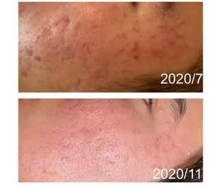 ニキビ改善サロン　縁樹　enju所属・ニキビ専門サロン縁樹 鈴木真樹のエステ・リラクイメージ