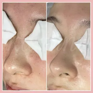 kanunu♡mana所属・豊橋/毛穴特化エステ 深層デトックスリンパのエステ・リラクイメージ