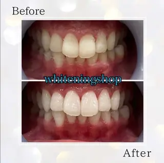 ホワイトニングショップ伊丹店所属・ホワイトニング ショップ伊丹店のその他イメージ