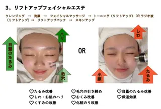 ヴィーナス ビューティーのエステ・リラクイメージ