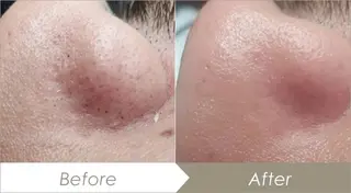 小顔コルギ・美肌 グラシーズのエステ・リラクイメージ