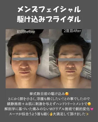 BLOSSOM 菊地のエステ・リラクイメージ