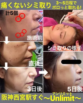 脱毛＆エステサロン【アンリミット】所属・森谷 莉美のエステ・リラクイメージ