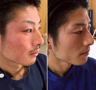 夜限定SARON 💎YISM💎のエステ・リラクイメージ