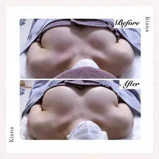 バスト専門Kiana 風のエステ・リラクイメージ