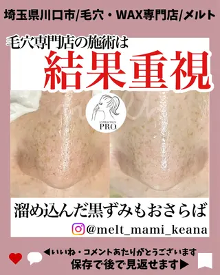 C. Lのマツエク・マツパデザイン