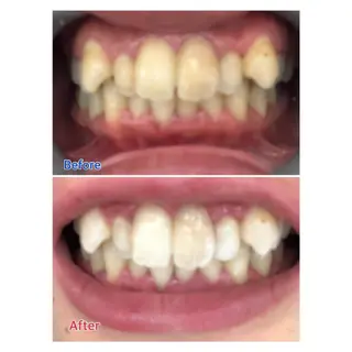 MBEAUTYSALON 千葉店・京成大久保所属・Melty 輝のその他イメージ