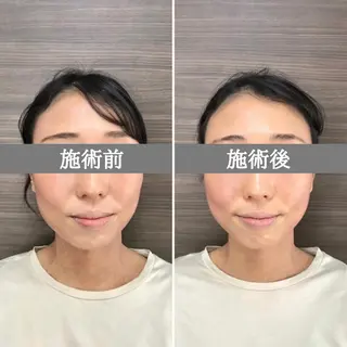 Looom 田中里奈のその他イメージ