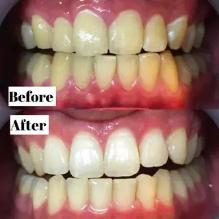 LBS吉祥寺 公式のエステ・リラクイメージ