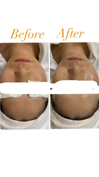 ビューティーサロン　プリズム所属・久留本 茜のエステ・リラクイメージ