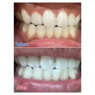 MBEAUTYSALON 千葉店・京成大久保所属・Melty 輝のその他イメージ