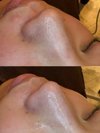 EARTH coiffure beaute 新潟紫竹山店所属・🤍アベシュリ /フェイシャル🤍のエステ・リラクイメージ