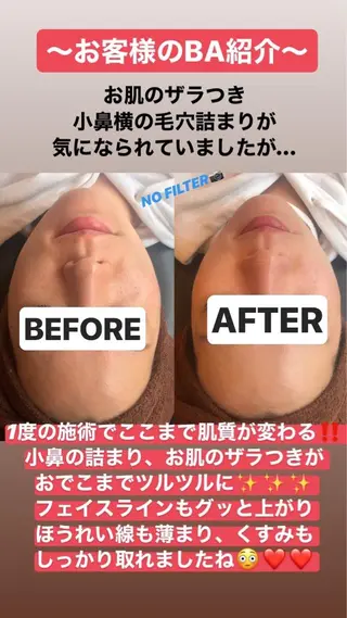 ショート カラー パーマ ヘアアレンジ メンズ キッズ ネイル マツエク・マツパ NANIOAFU [本町店]のその他イメージ