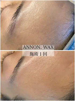 肌質改善ワックス専門 yukiのエステ・リラクイメージ