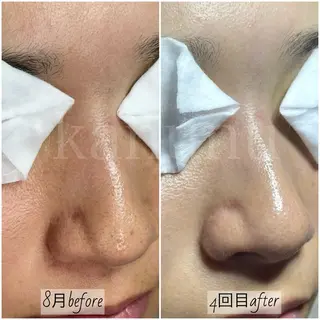 kanunu♡mana所属・豊橋/毛穴特化エステ 深層デトックスリンパのエステ・リラクイメージ