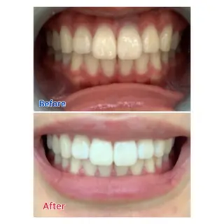 MBEAUTYSALON 千葉店・京成大久保所属・Melty 輝のその他イメージ