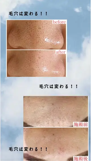 毛穴ケア専門サロン レーヌのエステ・リラクイメージ