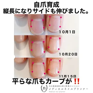 ネイル NAIL SALON ｔｏｇｇｙのネイルデザイン