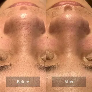 【頭痛、睡眠改善】 salon RUUのエステ・リラクイメージ