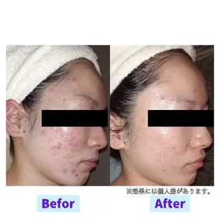 フェイシャルサロン Rosalieのエステ・リラクイメージ