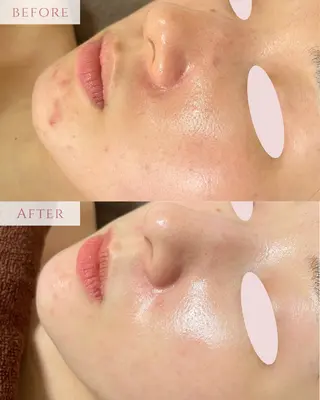 肌質改善サロン LesFleursのエステ・リラクイメージ