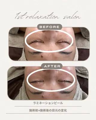 1st｜フェイシャル エステ専門店のエステ・リラクイメージ