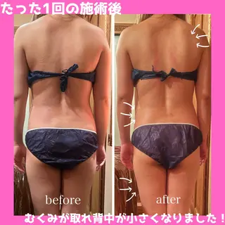 痩身&美肌サロン 堀米✨のその他イメージ