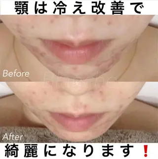 ショート カラー パーマ ヘアアレンジ ネイル マツエク・マツパ 都度払い肌質改善 &脱毛Blancheのエステ・リラクイメージ