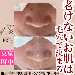 LULU所属・LULU ルルのエステ・リラクイメージ