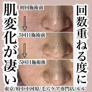 LULU所属・LULU ルルのエステ・リラクイメージ