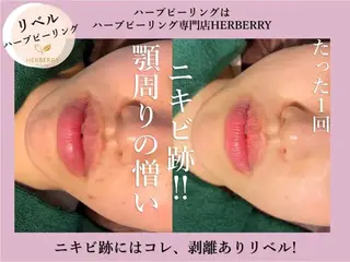 ハーブピーリング専門店HERBERRY難波心斎橋店所属・ハーブピーリング専門 HERBERRY冨永のエステ・リラクイメージ