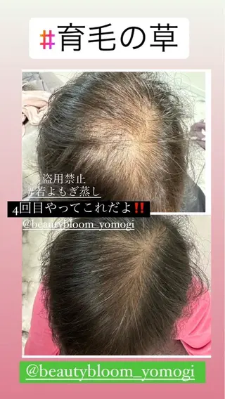 private salon  Dea_maris シュガーリング＆パーソナルボディケア所属・シミ改善・韓国肌管理 ボディメイク痩身のその他イメージ