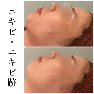 ハーブピーリング専門 BIOEL横浜のエステ・リラクイメージ