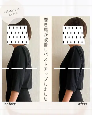 小顔矯正& 慢性肩こり腰痛改善店のエステ・リラクイメージ