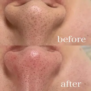 Petitmaison所属・Petit maisonのネイルデザイン