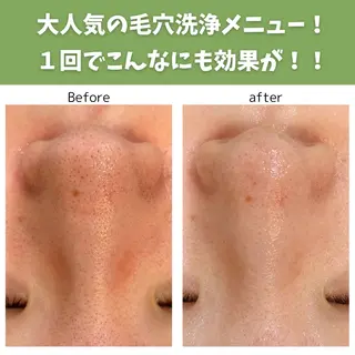 leolo武蔵浦和 肌質改善＆脱毛のエステ・リラクイメージ