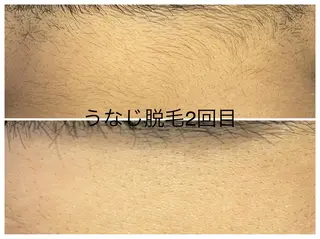 メンズ 医療提携メンズ脱毛 CDFAkasakaのエステ・リラクイメージ