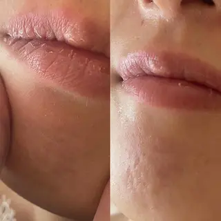 amu nail. RINAのネイルデザイン